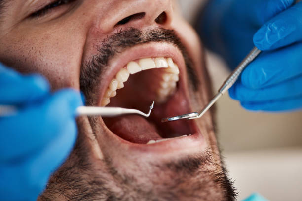 Best Emergency Treatment for Toothache in Keokuk, IA